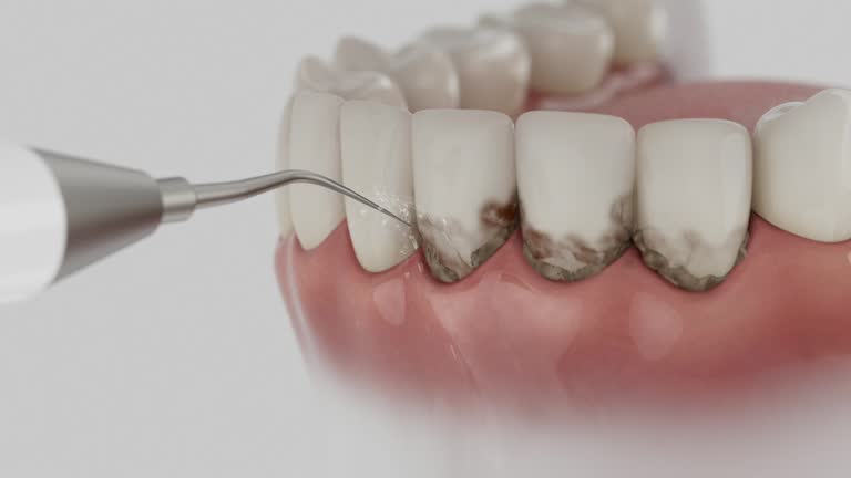 Trusted Wisdom Tooth Removal service in Maple Bluff, WI - Dentist Open Now